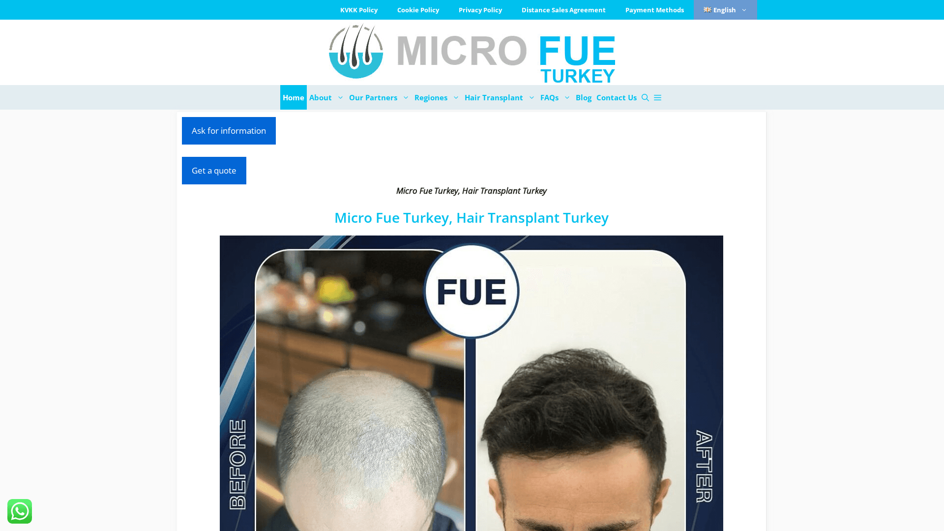 Micro fue Turkey